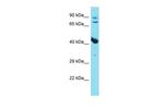 Myostatin Antibody in Western Blot (WB)