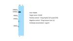 CD109 Antibody in Western Blot (WB)