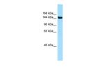 CD109 Antibody in Western Blot (WB)