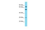 MTMR7 Antibody in Western Blot (WB)