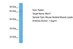 MTMR7 Antibody in Western Blot (WB)