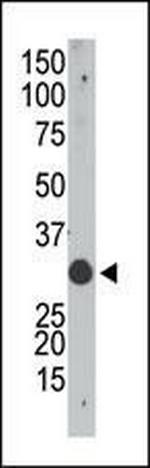 APOBEC1 Antibody in Western Blot (WB)