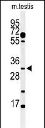 APOBEC3B Antibody in Western Blot (WB)