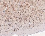 KCNB1 Antibody in Immunohistochemistry (Paraffin) (IHC (P))