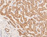 ZACN Antibody in Immunohistochemistry (Paraffin) (IHC (P))