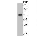 ADT2 Antibody in Western Blot (WB)