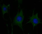 P2X1 Antibody in Immunocytochemistry (ICC/IF)