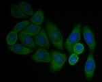 P2X1 Antibody in Immunocytochemistry (ICC/IF)