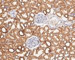 P2X1 Antibody in Immunohistochemistry (Paraffin) (IHC (P))