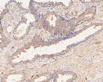 P2X1 Antibody in Immunohistochemistry (Paraffin) (IHC (P))