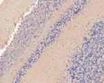 P2X1 Antibody in Immunohistochemistry (Paraffin) (IHC (P))