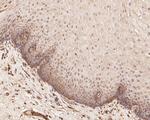 ZHX2 Antibody in Immunohistochemistry (Paraffin) (IHC (P))