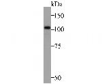 ZHX2 Antibody in Western Blot (WB)