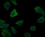 Desmoglein 3 Antibody in Immunocytochemistry (ICC/IF)