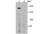 CD35 Antibody in Western Blot (WB)