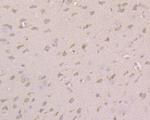 CACNG2 Antibody in Immunohistochemistry (Paraffin) (IHC (P))