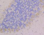 CACNG2 Antibody in Immunohistochemistry (Paraffin) (IHC (P))