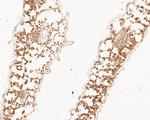 Beta-adaptin-like protein A Antibody in Immunohistochemistry (Paraffin) (IHC (P))