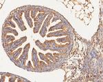 GM648 Antibody in Immunohistochemistry (Paraffin) (IHC (P))