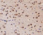 KCNN2 Antibody in Immunohistochemistry (Paraffin) (IHC (P))