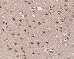 KCNN2 Antibody in Immunohistochemistry (Paraffin) (IHC (P))