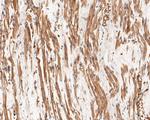 CHRNA1 Antibody in Immunohistochemistry (Paraffin) (IHC (P))