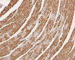 CHRNA1 Antibody in Immunohistochemistry (Paraffin) (IHC (P))