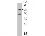 CHRNA1 Antibody in Western Blot (WB)