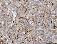 MRC1 Antibody in Immunohistochemistry (Paraffin) (IHC (P))