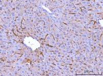 MRC1 Antibody in Immunohistochemistry (Paraffin) (IHC (P))