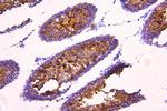 ACACB Antibody in Immunohistochemistry (Paraffin) (IHC (P))