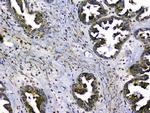 SIRT4 Antibody in Immunohistochemistry (Paraffin) (IHC (P))