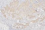SEMA3B Antibody in Immunohistochemistry (Paraffin) (IHC (P))