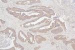 SEMA3B Antibody in Immunohistochemistry (Paraffin) (IHC (P))