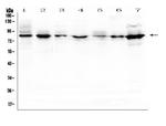 SEMA3B Antibody in Western Blot (WB)