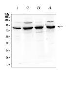 SEMA3B Antibody in Western Blot (WB)