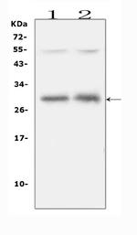 IL-31 Antibody in Western Blot (WB)