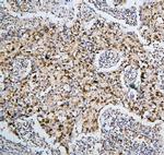 PHF21A Antibody in Immunohistochemistry (Paraffin) (IHC (P))