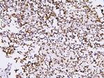 PHF21A Antibody in Immunohistochemistry (Paraffin) (IHC (P))