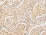 ATP5G1/2/3 Antibody in Immunohistochemistry (Paraffin) (IHC (P))