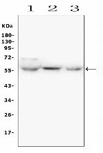 SLC2A6 Antibody in Western Blot (WB)