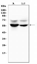 SLC2A6 Antibody in Western Blot (WB)