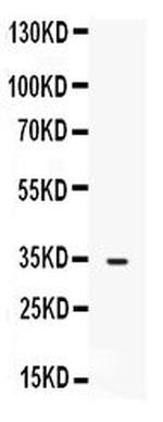 FGF23 Antibody in Western Blot (WB)