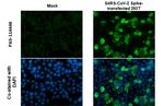 SARS-CoV-2 Spike Protein S1 Antibody in Immunocytochemistry (ICC/IF)