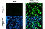 SARS-CoV-2 Spike Protein (RBD) Antibody in Immunocytochemistry (ICC/IF)