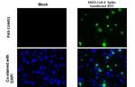 SARS-CoV-2 Spike Protein (RBD) Antibody in Immunocytochemistry (ICC/IF)