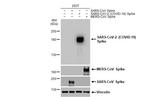 SARS-CoV-2 Spike Protein (RBD) Antibody in Western Blot (WB)