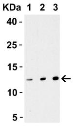 Strep Tag Antibody in Western Blot (WB)