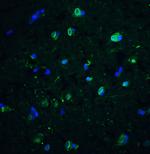 CD81 Antibody in Immunohistochemistry (Paraffin) (IHC (P))