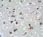 CD81 Antibody in Immunohistochemistry (Paraffin) (IHC (P))